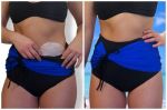 Ostomy bikini bottom (mod. nbl)