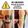 Fascia Braccio LB